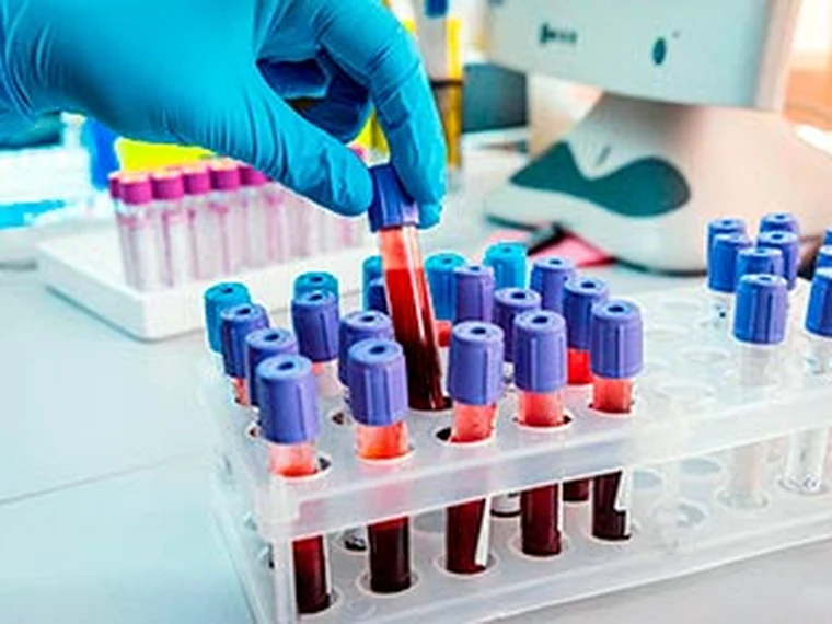 Laboratorio Clínico en Quito